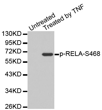 RELA / NFKB p65 Antibody - Western blot analysis of extracts from Hela cells.