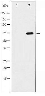 RELA / NFKB p65 Antibody - Western blot of NF- kappaB p65 phosphorylation expression in MOLT whole cell lysates,The lane on the left is treated with the antigen-specific peptide.