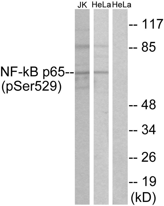RELA / NFKB p65 Antibody - Western blot analysis of lysates from HeLa and Jurkat cells, using NF-kappaB p65 (Phospho-Ser529) Antibody. The lane on the right is blocked with the phospho peptide.
