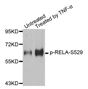 RELA / NFKB p65 Antibody - Western blot analysis of extracts from 293 cells.