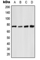 RELA / NFKB p65 Antibody - Western blot analysis of NF-kappaB p65 (pS529) expression in MCF7 UV-treated (A); Raw264.7 TNFa-treated (B); rat liver (C); rat kidney (D) whole cell lysates.