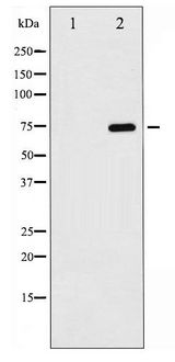 RELA / NFKB p65 Antibody - Western blot of NF- kappaB p65 phosphorylation expression in TNF- alpha treated MDA-MB-231 whole cell lysates,The lane on the left is treated with the antigen-specific peptide.
