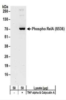 RELA / NFKB p65 Antibody - Detection of Human Phospho RelA (S536) by Western Blot. Samples: Whole cell lysate (50 ug) from Jurkat cells treated with TNF alpha and Calyculin A (+) or mock treated (-). Antibodies: Affinity purified rabbit anti-Phospho RelA (S536) antibody used for WB at 0.1 ug/ml. Detection: Chemiluminescence with an exposure time of 30 seconds.