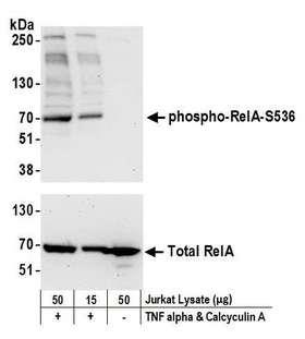 RELA / NFKB p65 Antibody - Detection of human phospho RelA-S536 by western blot. Samples: Whole cell lysate (15 and 50 µg) from Jurkat cells treated with TNF alpha and Calyculin A (+) or mock treated (-). Antibodies: Affinity purified rabbit anti-Phospho RelA (S536) antibody used for WB at 0.1 µg/ml. Detection: Chemiluminescence with an exposure time of 30 seconds. Lower panel: Western blot for total RelA using affinity purified rabbit anti-RelA antibody at 0.1 µg/ml with exposure time of 75 seconds.