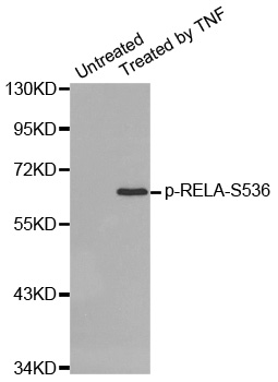 RELA / NFKB p65 Antibody - Western blot analysis of extracts from HepG2 cells.