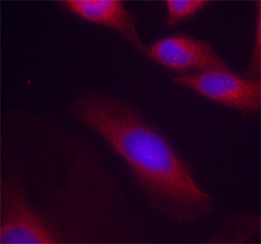 RELA / NFKB p65 Antibody - Immunofluorescence staining of methanol-fixed Hela cells.
