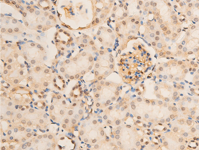 RELA / NFKB p65 Antibody - 1:100 staining mouse kidney tissue by IHC-P. The tissue was formaldehyde fixed and a heat mediated antigen retrieval step in citrate buffer was performed. The tissue was then blocked and incubated with the antibody for 1.5 hours at 22°C. An HRP conjugated goat anti-rabbit antibody was used as the secondary.
