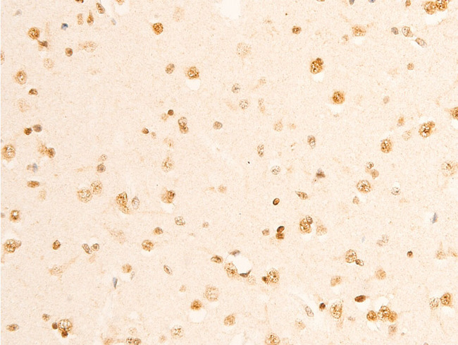 RELA / NFKB p65 Antibody - 1:100 staining human brain tissue by IHC-P. The tissue was formaldehyde fixed and a heat mediated antigen retrieval step in citrate buffer was performed. The tissue was then blocked and incubated with the antibody for 1.5 hours at 22°C. An HRP conjugated goat anti-rabbit antibody was used as the secondary.