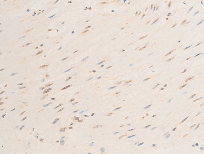 RELA / NFKB p65 Antibody - 1:100 staining human heart tissue by IHC-P. The tissue was formaldehyde fixed and a heat mediated antigen retrieval step in citrate buffer was performed. The tissue was then blocked and incubated with the antibody for 1.5 hours at 22°C. An HRP conjugated goat anti-rabbit antibody was used as the secondary.