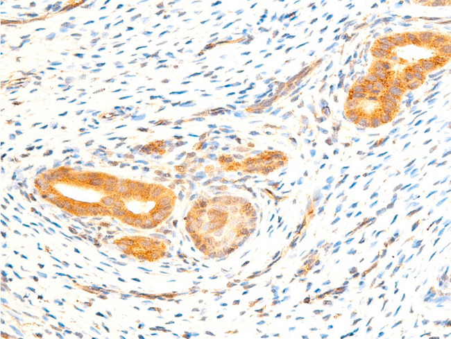 RELA / NFKB p65 Antibody - 1:100 staining rat uterine tissue by IHC-P. The tissue was formaldehyde fixed and a heat mediated antigen retrieval step in citrate buffer was performed. The tissue was then blocked and incubated with the antibody for 1.5 hours at 22°C. An HRP conjugated goat anti-rabbit antibody was used as the secondary.