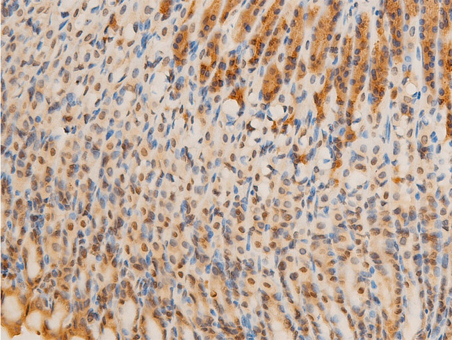 RELA / NFKB p65 Antibody - 1:100 staining mouse gastric tissue by IHC-P. The tissue was formaldehyde fixed and a heat mediated antigen retrieval step in citrate buffer was performed. The tissue was then blocked and incubated with the antibody for 1.5 hours at 22°C. An HRP conjugated goat anti-rabbit antibody was used as the secondary.