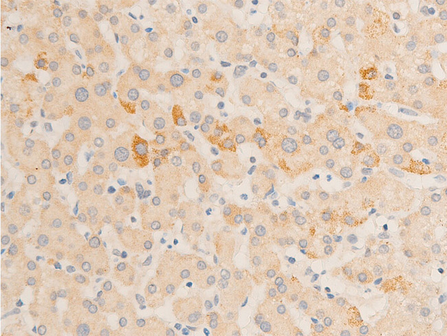 RELA / NFKB p65 Antibody - 1:100 staining human liver tissue by IHC-P. The tissue was formaldehyde fixed and a heat mediated antigen retrieval step in citrate buffer was performed. The tissue was then blocked and incubated with the antibody for 1.5 hours at 22°C. An HRP conjugated goat anti-rabbit antibody was used as the secondary.