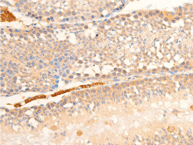 RELA / NFKB p65 Antibody - 1:100 staining mouse testis tissue by IHC-P. The tissue was formaldehyde fixed and a heat mediated antigen retrieval step in citrate buffer was performed. The tissue was then blocked and incubated with the antibody for 1.5 hours at 22°C. An HRP conjugated goat anti-rabbit antibody was used as the secondary.