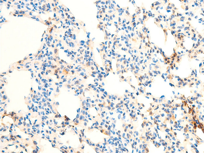RELA / NFKB p65 Antibody - 1:100 staining rat lung tissue by IHC-P. The tissue was formaldehyde fixed and a heat mediated antigen retrieval step in citrate buffer was performed. The tissue was then blocked and incubated with the antibody for 1.5 hours at 22°C. An HRP conjugated goat anti-rabbit antibody was used as the secondary.