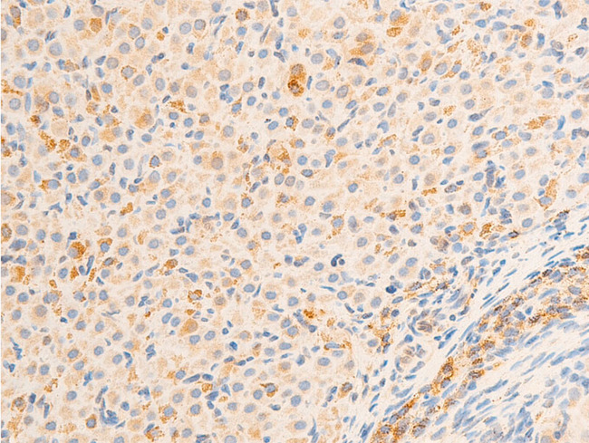 RELA / NFKB p65 Antibody - 1:100 staining rat ovarian tissue by IHC-P. The tissue was formaldehyde fixed and a heat mediated antigen retrieval step in citrate buffer was performed. The tissue was then blocked and incubated with the antibody for 1.5 hours at 22°C. An HRP conjugated goat anti-rabbit antibody was used as the secondary.