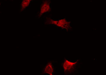 RELA / NFKB p65 Antibody - Staining HeLa cells by IF/ICC. The samples were fixed with PFA and permeabilized in 0.1% Triton X-100, then blocked in 10% serum for 45 min at 25°C. The primary antibody was diluted at 1:200 and incubated with the sample for 1 hour at 37°C. An Alexa Fluor 594 conjugated goat anti-rabbit IgG (H+L) Ab, diluted at 1/600, was used as the secondary antibody.