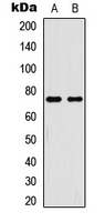 RELA / NFKB p65 Antibody - Western blot analysis of NF-kappaB p65 (pT254) expression in HeLa TNFa-treated (A); HL60 TNFa-treated (B) whole cell lysates.