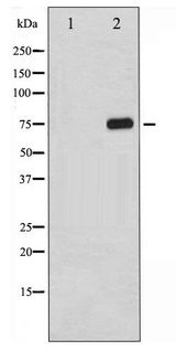 RELA / NFKB p65 Antibody - Western blot of NF- kappaB p65 phosphorylation expression in TNF- alpha treated 293 whole cell lysates,The lane on the left is treated with the antigen-specific peptide.