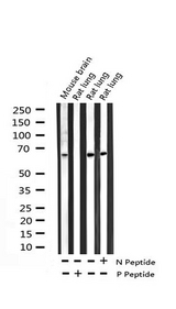 RELA / NFKB p65 Antibody - Western blot analysis of Phospho-NF-kappaB p65 (Thr254) expression in various lysates