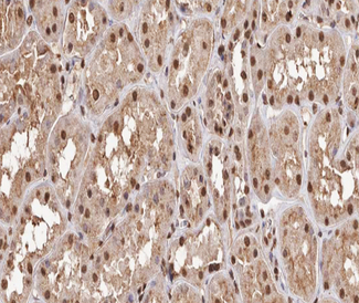 RELA / NFKB p65 Antibody - 1:200 staining human kidney tissue by IHC-P. The tissue was formaldehyde fixed and a heat mediated antigen retrieval step in citrate buffer was performed. The tissue was then blocked and incubated with the antibody for 1.5 hours at 22°C. An HRP conjugated goat anti-rabbit antibody was used as the secondary.