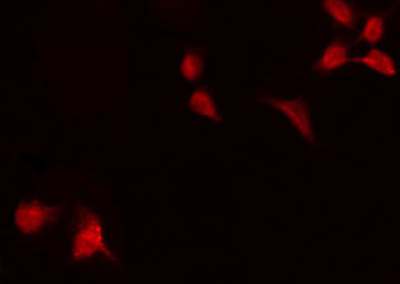 RELA / NFKB p65 Antibody - Staining HeLa cells by IF/ICC. The samples were fixed with PFA and permeabilized in 0.1% Triton X-100, then blocked in 10% serum for 45 min at 25°C. The primary antibody was diluted at 1:200 and incubated with the sample for 1 hour at 37°C. An Alexa Fluor 594 conjugated goat anti-rabbit IgG (H+L) Ab, diluted at 1/600, was used as the secondary antibody.