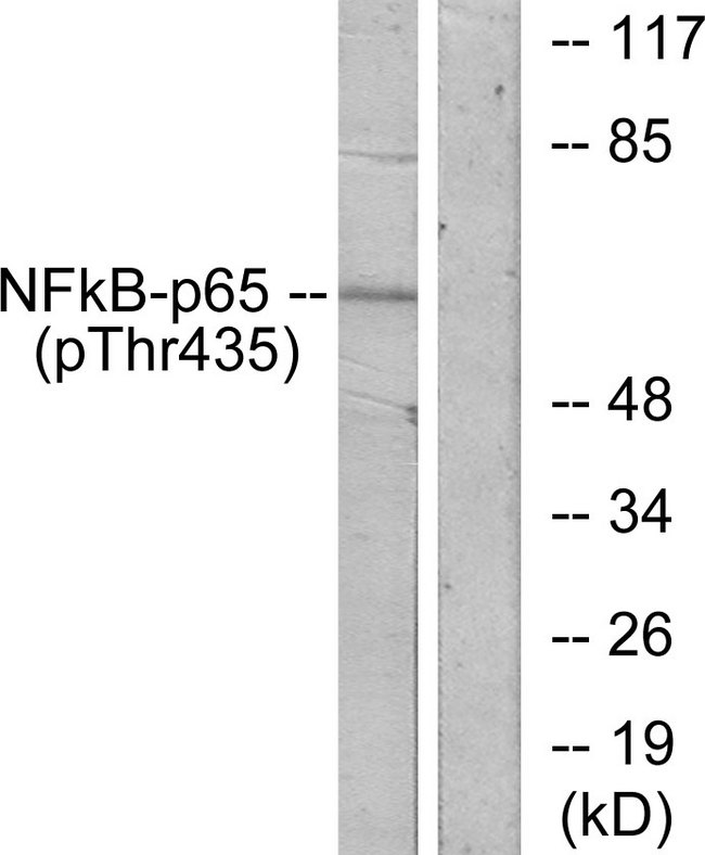 RELA / NFKB p65 Antibody - Western blot analysis of lysates from COS7 cells treated with TNF-alpha, using NF-kappaB p65 (Phospho-Thr435) Antibody. The lane on the right is blocked with the phospho peptide.