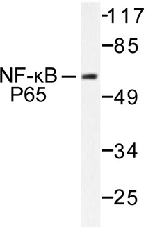 RELA / NFKB p65 Antibody - Western blot of NFB-p65 (T429) pAb in extracts from COS7 treated with TNF-.
