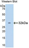 RELB Antibody - Western blot of recombinant RELB.  This image was taken for the unconjugated form of this product. Other forms have not been tested.