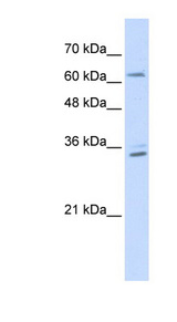 RELB Antibody - RELB antibody Western blot of Transfected 293T cell lysate. This image was taken for the unconjugated form of this product. Other forms have not been tested.