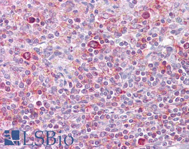 RELB Antibody - Anti-RELB antibody IHC of human spleen. Immunohistochemistry of formalin-fixed, paraffin-embedded tissue after heat-induced antigen retrieval. Antibody concentration 5 ug/ml.  This image was taken for the unconjugated form of this product. Other forms have not been tested.