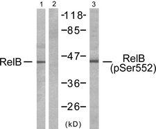 RELB Antibody - Western blot analysis of extracts from HepG2 cells, using RelB (Ab-552) antibody (Line 1 and 2) and RelB (Phospho-Ser552) antibody (Line 3).