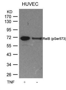 RELB Antibody - Western blot of extracts from HUVEC cells untreated or treated with TNF using RelB(Phospho-Ser573) antibody.