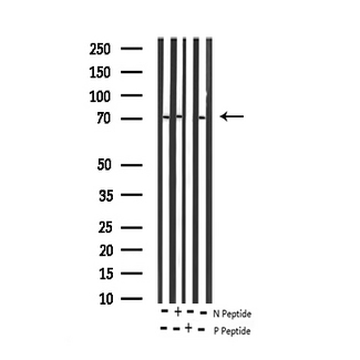 RELB Antibody - Western blot analysis of Phospho-RelB (Ser552) expression in various lysates