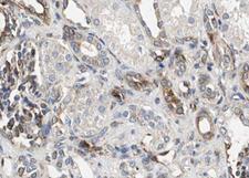 RELB Antibody - 1:100 staining human kidney tissue by IHC-P. The tissue was formaldehyde fixed and a heat mediated antigen retrieval step in citrate buffer was performed. The tissue was then blocked and incubated with the antibody for 1.5 hours at 22°C. An HRP conjugated goat anti-rabbit antibody was used as the secondary.