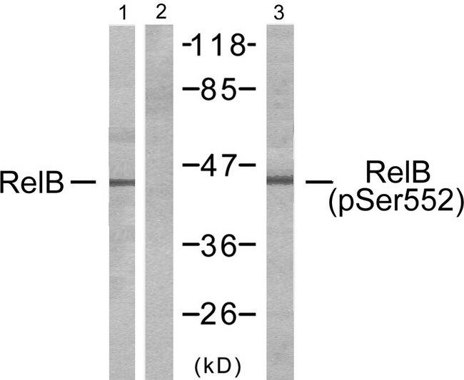 RELB Antibody - Western blot analysis of extracts from HepG2 cells, using RelB (Ab-552) antibody (Line 1 and 2) and RelB (Phospho-Ser552) antibody (Line 3).