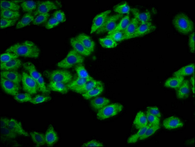 REM1 / REM-1 Antibody - Immunofluorescence staining of HepG2 cells diluted at 1:133, counter-stained with DAPI. The cells were fixed in 4% formaldehyde, permeabilized using 0.2% Triton X-100 and blocked in 10% normal Goat Serum. The cells were then incubated with the antibody overnight at 4°C.The Secondary antibody was Alexa Fluor 488-congugated AffiniPure Goat Anti-Rabbit IgG (H+L).