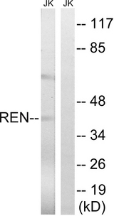 REN / Renin 1 Antibody - Western blot analysis of lysates from Jurkat cells, using REN Antibody. The lane on the right is blocked with the synthesized peptide.
