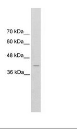 REN / Renin 1 Antibody - HepG2 Cell Lysate.  This image was taken for the unconjugated form of this product. Other forms have not been tested.
