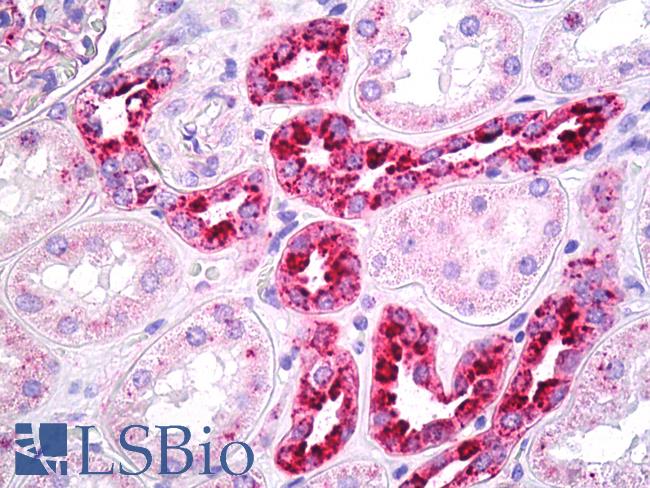 REN / Renin 1 Antibody - Anti-REN / Renin antibody IHC of human kidney, tubules. Immunohistochemistry of formalin-fixed, paraffin-embedded tissue after heat-induced antigen retrieval. Antibody concentration 10 ug/ml.