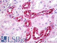 REN / Renin 1 Antibody - Anti-REN / Renin antibody IHC of human kidney, tubules. Immunohistochemistry of formalin-fixed, paraffin-embedded tissue after heat-induced antigen retrieval. Antibody concentration 10 ug/ml.