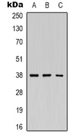 REN / Renin 1 Antibody - Western blot analysis of Renin expression in K562 (A); Jurkat (B); HEK293T (C) whole cell lysates.