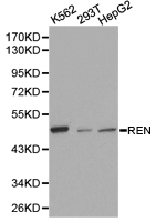 REN / Renin 1 Antibody - Western blot of extracts of various cell lines, using REN antibody.