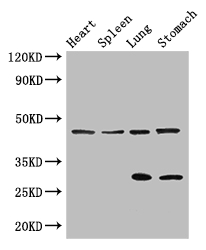 REN / Renin 1 Antibody - Positive WB detected in:Mouse heart tissue,Mouse spleen tissue,Mouse lung tissue,Mouse stomach tissue;All lanes: REN antibody at 3ug/ml;Secondary;Goat polyclonal to rabbit IgG at 1/50000 dilution;Predicted band size: 46,45 kDa;Observed band size: 46,29 kDa;