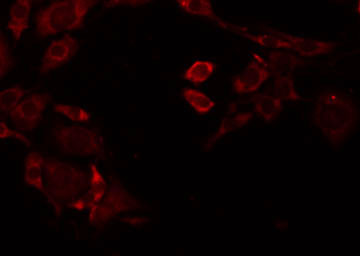 REN / Renin 1 Antibody - Staining HeLa cells by IF/ICC. The samples were fixed with PFA and permeabilized in 0.1% Triton X-100, then blocked in 10% serum for 45 min at 25°C. The primary antibody was diluted at 1:200 and incubated with the sample for 1 hour at 37°C. An Alexa Fluor 594 conjugated goat anti-rabbit IgG (H+L) Ab, diluted at 1/600, was used as the secondary antibody.