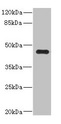 Ren2 / Renin-2 Antibody - Western blot All lanes: Ren2 antibody at 2µg/ml + MCF-7 whole cell lysate Secondary Goat polyclonal to rabbit IgG at 1/10000 dilution Predicted band size: 44 kDa Observed band size: 44 kDa