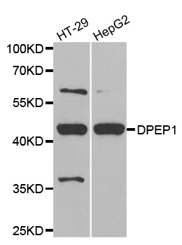 Renal Dipeptidase / DPEP1 Antibody - Western blot analysis of extracts of various cell lines.