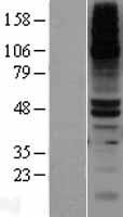 Renal Dipeptidase / DPEP1 Protein - Western validation with an anti-DDK antibody * L: Control HEK293 lysate R: Over-expression lysate