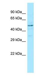 RENBP Antibody - RENBP antibody Western Blot of 721_B.  This image was taken for the unconjugated form of this product. Other forms have not been tested.