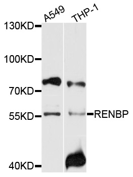 RENBP Antibody - Western blot analysis of extracts of various cell lines, using RENBP antibody at 1:1000 dilution. The secondary antibody used was an HRP Goat Anti-Rabbit IgG (H+L) at 1:10000 dilution. Lysates were loaded 25ug per lane and 3% nonfat dry milk in TBST was used for blocking. An ECL Kit was used for detection and the exposure time was 5s.