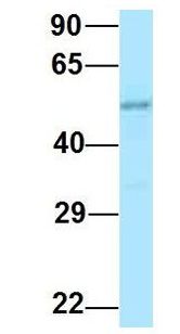 RENBP Antibody - RENBP antibody Western Blot of Human Placenta. Antibody Dilution: 1.0 ug/ml. Antibody dilution: 1 ug/ml.  This image was taken for the unconjugated form of this product. Other forms have not been tested.